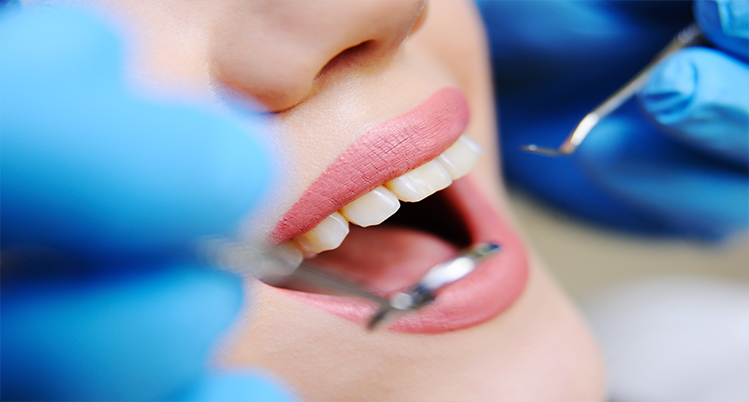 歯茎の検査の概要