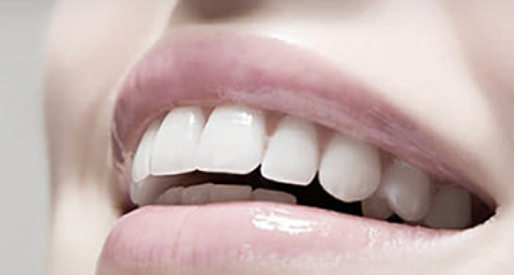 歯を綺麗に見せたいならセラミックとホワイトニング、どっちがおすすめ？